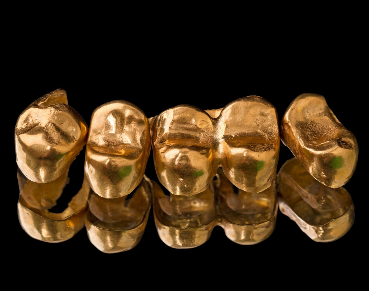 Скупка  стоматологического золота в Калининграде